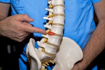 Por que me doe a parte traseira na parte inferior das costas e que facer