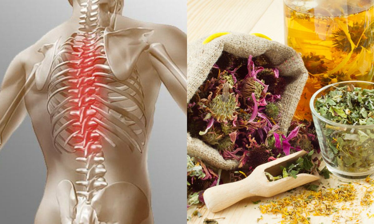 Osteocondrose do pescozo métodos populares